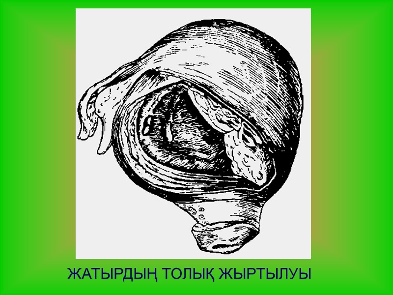 ЖАТЫРДЫҢ ТОЛЫҚ ЖЫРТЫЛУЫ